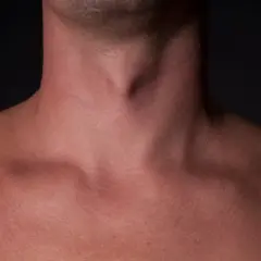 Jabłko Adama u mężczyzn - poznaj prawdę o tej męskiej cesze anatomicznej