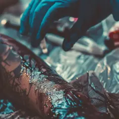 Siniak po tatuażu - Jak unikać siniaków po tatuowaniu? Porady ekspertów