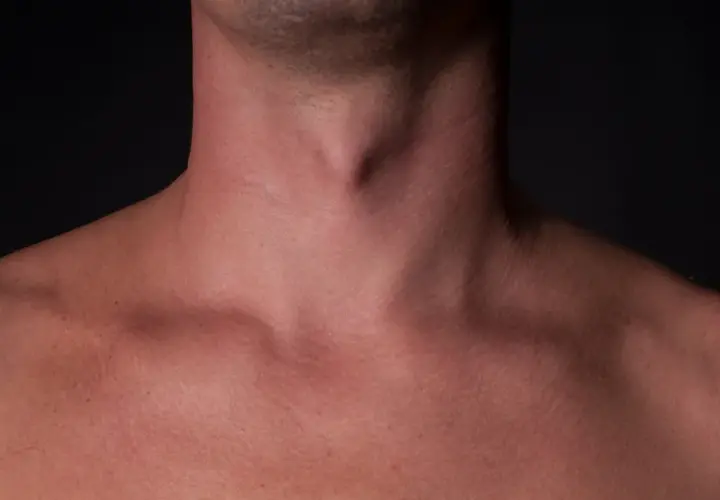 Jabłko Adama u mężczyzn - poznaj prawdę o tej męskiej cesze anatomicznej