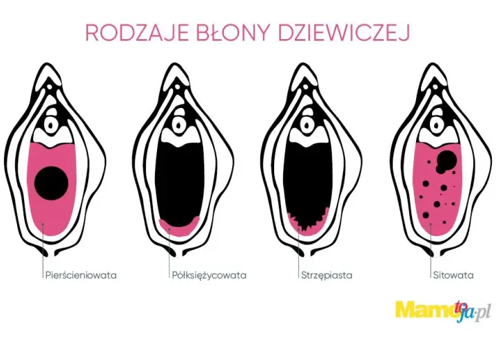 Czy mężczyzna czuje przebicie błony dziewiczej? Oto prawda, której nie znasz